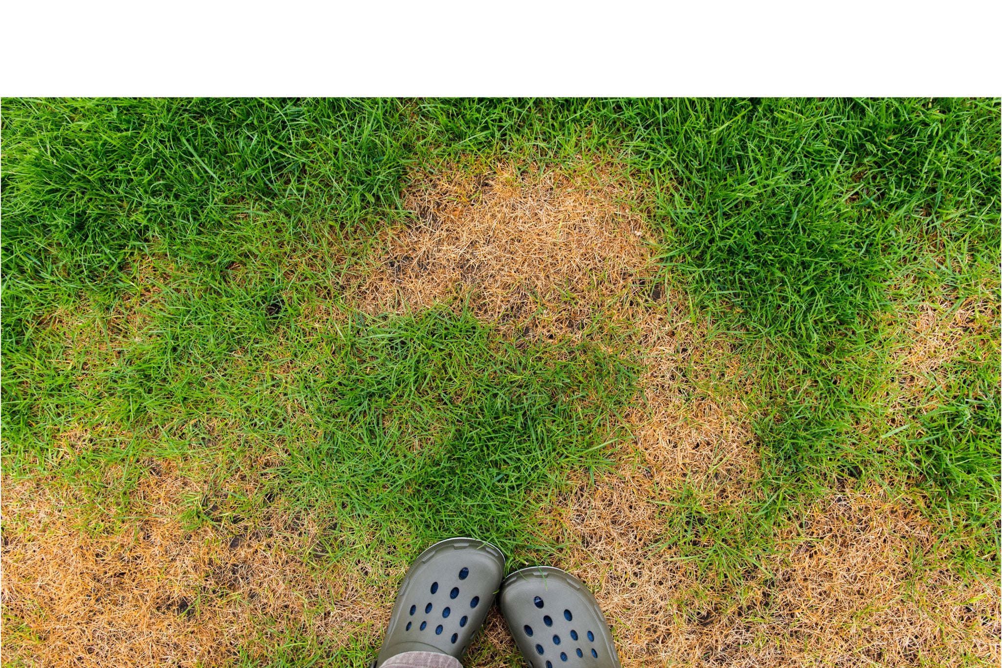 Grüner Rasen mit braunen, vertrockneten Flecken und graue Schuhe am unteren Bildrand